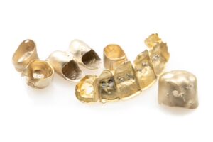 Zahngold verkaufen in Berlin